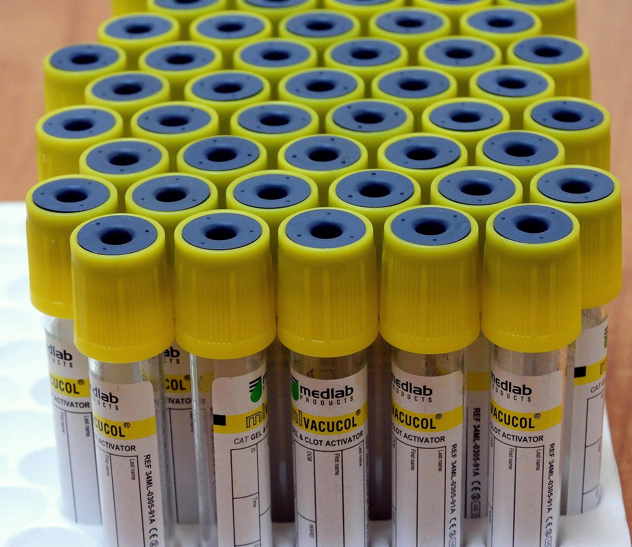 弱视最新动态，研究、治疗与未来展望